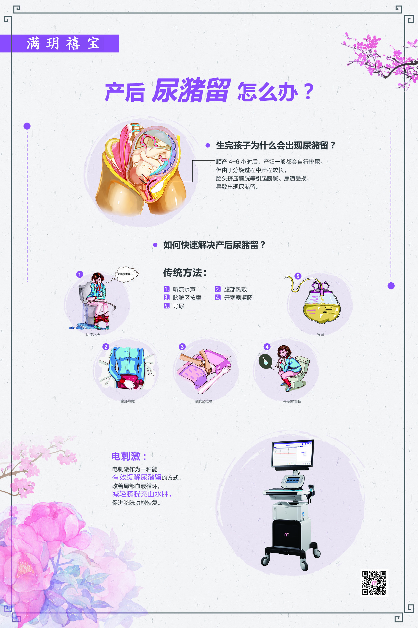 产后尿潴留