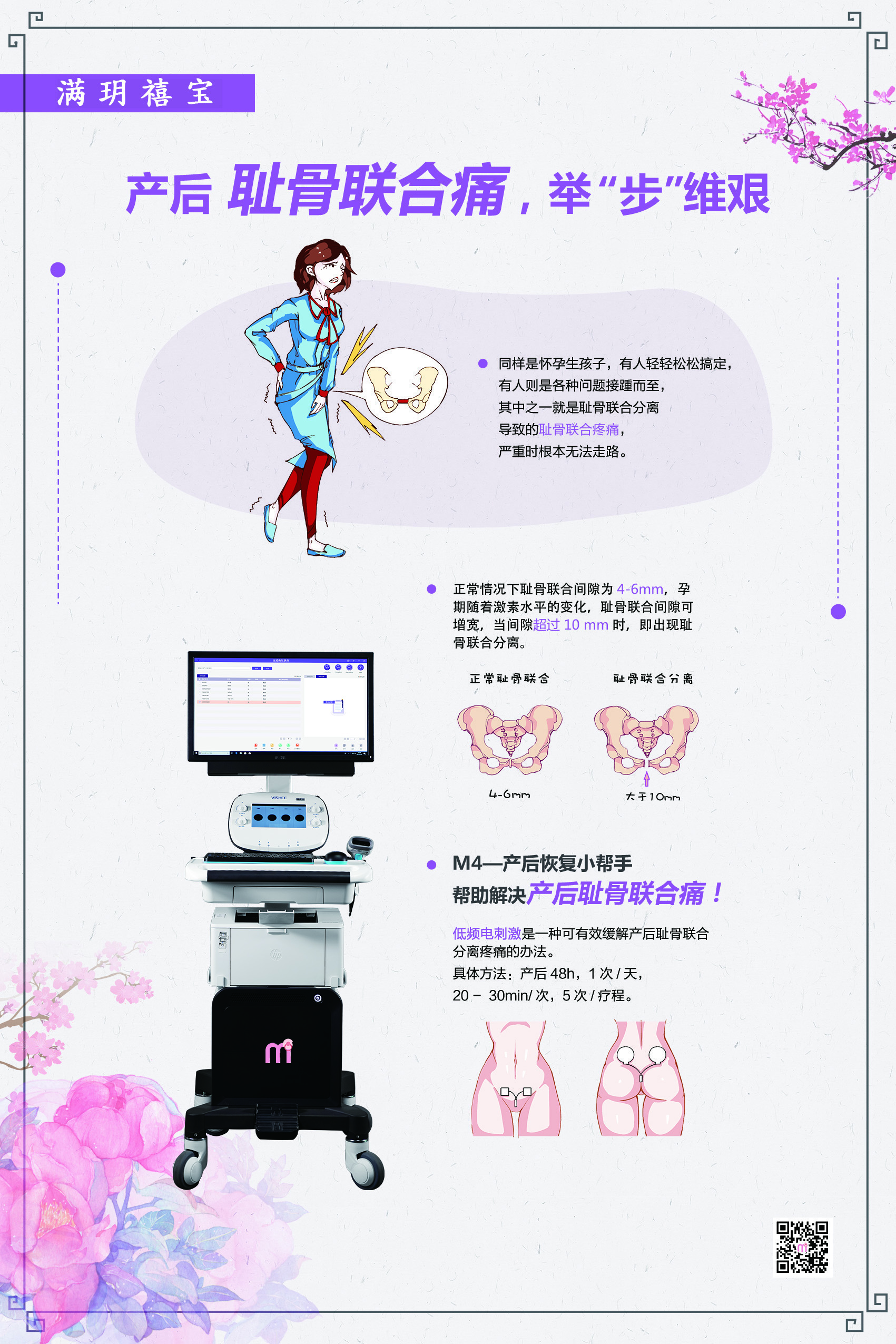 耻骨联合痛